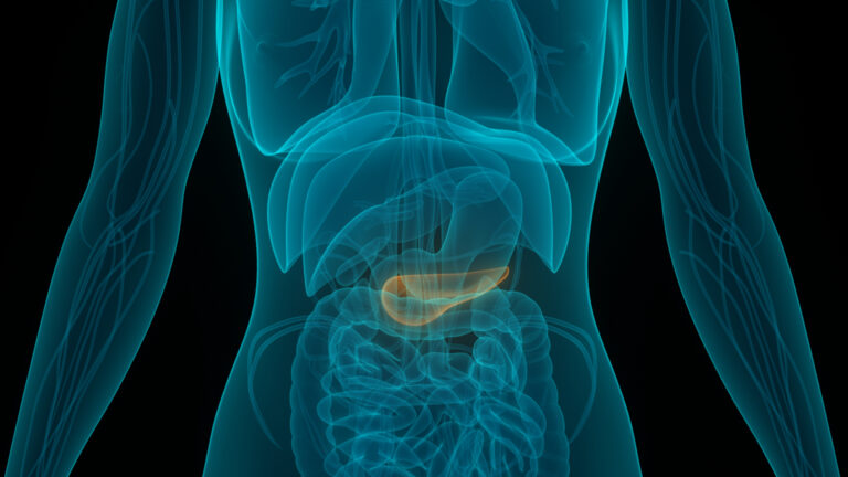 A transparent digital illustration of the human torso highlighting the pancreas, indicating pancreatic cancer within the digestive system.