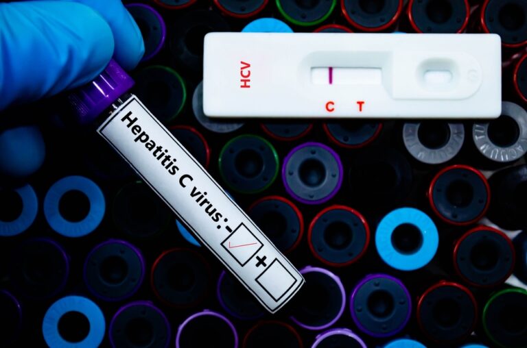 A gloved hand holding a blood sample tube labeled 'Hepatitis C virus' with a negative result indicated. Next to it is a rapid test cassette marked 'HCV' showing a single control line (C), indicating a negative test result. The background is filled with colorful blood collection tubes.